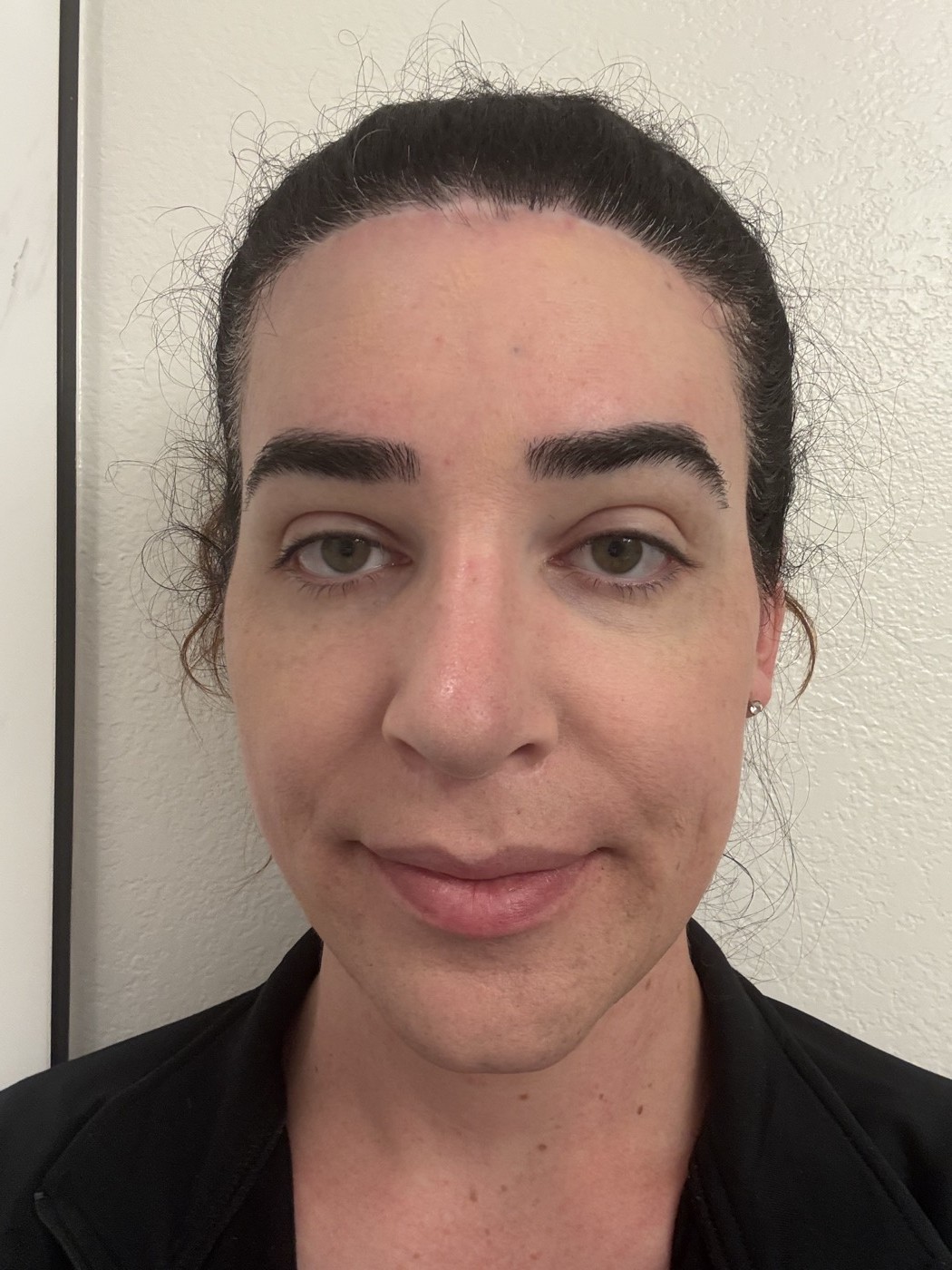 Face after foundation: the redness visible in the post-sunscreen photo has been pulled into the surrounding skin tone, creating one even complexion across the nose and cheeks